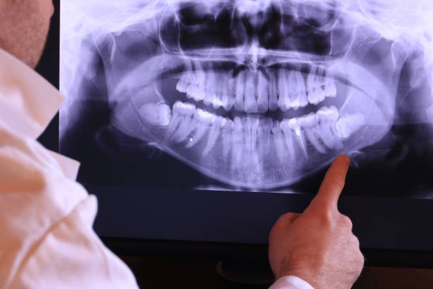 Best Urgent Dental Care for Toothache in Wmington, IL