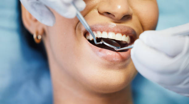 Best Emergency Dentist for Knocked-Out Tooth in Wmington, IL